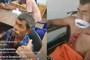 Ambalangoda Police Officer Transferred as Probe Launched into Alleged Custodial Assault